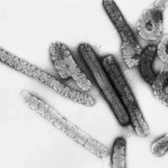 Marburg Hemorrhagic Fever